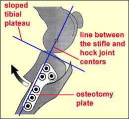 Knee Surgery