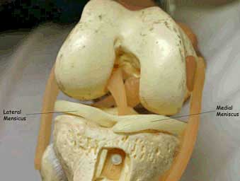 Meniscal Injury